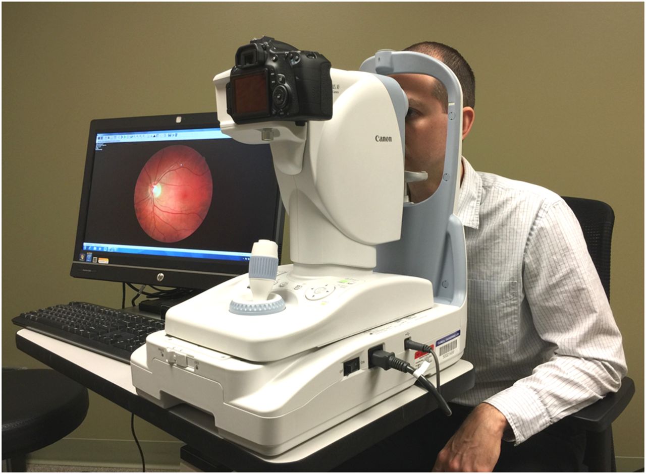 Fundus Photography